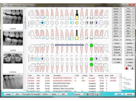 epms dental software|Aspen Dental Launches Digitally Enhanced Patient Experience in .